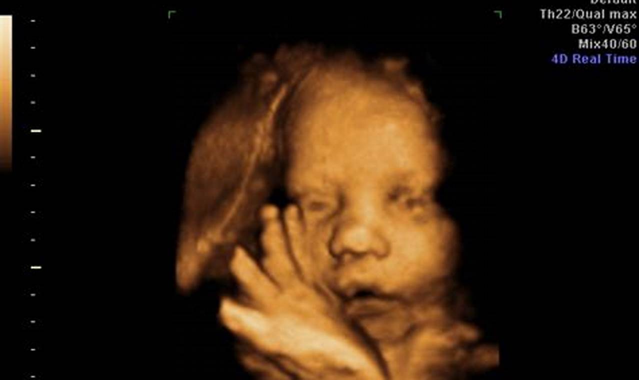 Unforgettable Bonding: Your Guide to 28 Weeks Pregnant 3D Ultrasound