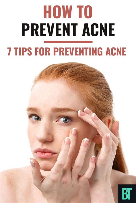 3 Top Acne Skin Care Tips For A Healthier Skin Acne skin, Skin care
