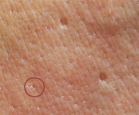Unveiling the Mysterious Symbol: 3 Dots in a Triangle on Skin