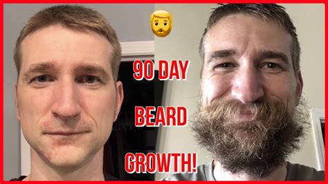 3 Month Beard Growth Time Lapse