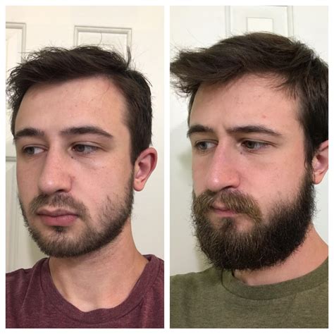 3 Month Beard Progress