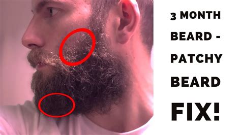 3 Month Beard Styles
