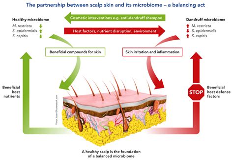 3 Scalp Therapy for a Balanced Scalp Microbiome
