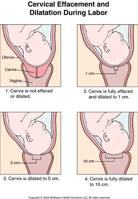 3 centimeters dilated and 80 effaced