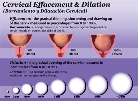 Understanding Your Pregnancy: What Does Being 3 cm Dilated Mean for You and Your Baby?