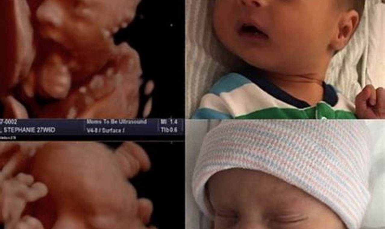 32-Week Ultrasound: Before and After - A Visual Journey of Your Baby's Growth