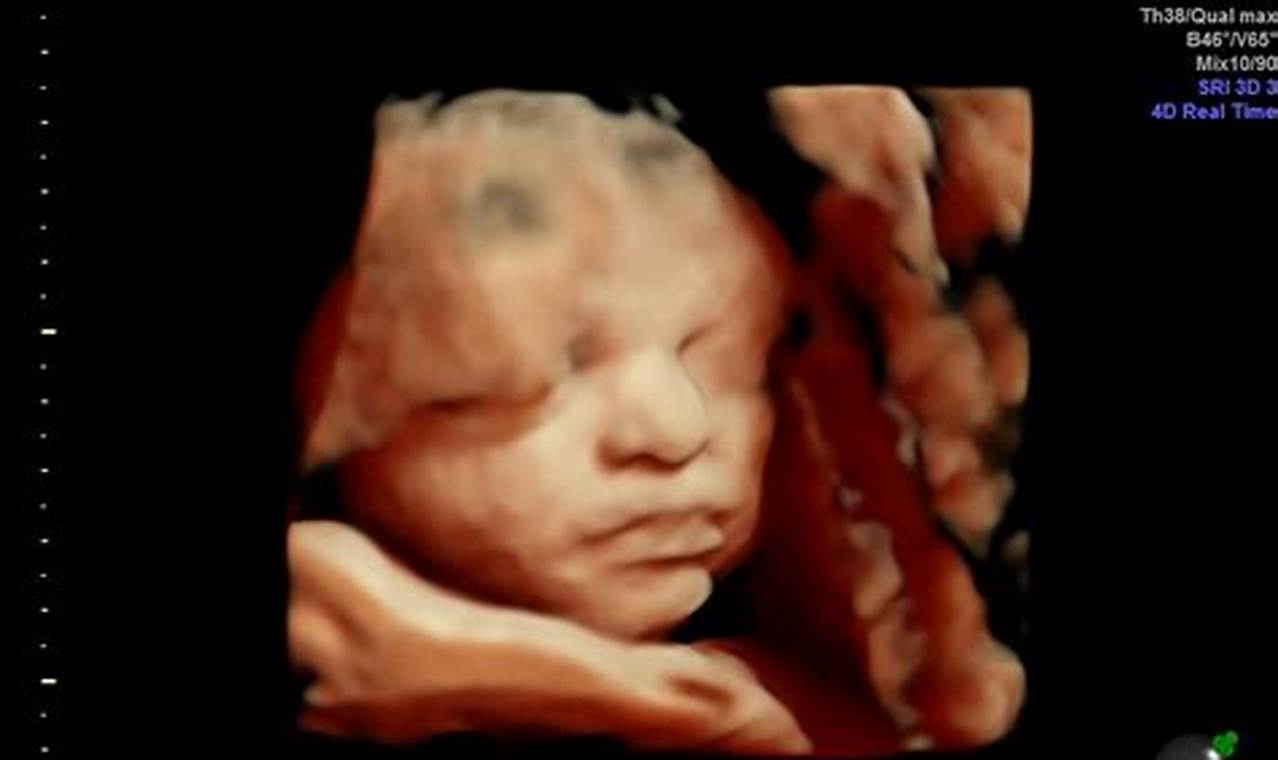 Tips for Capturing Stunning 32 week 3d Ultrasound Pictures