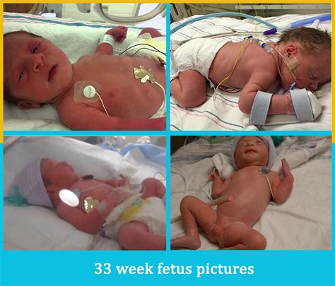 Your 33-Week-Old Fetus: Developmental Milestones and What to Expect