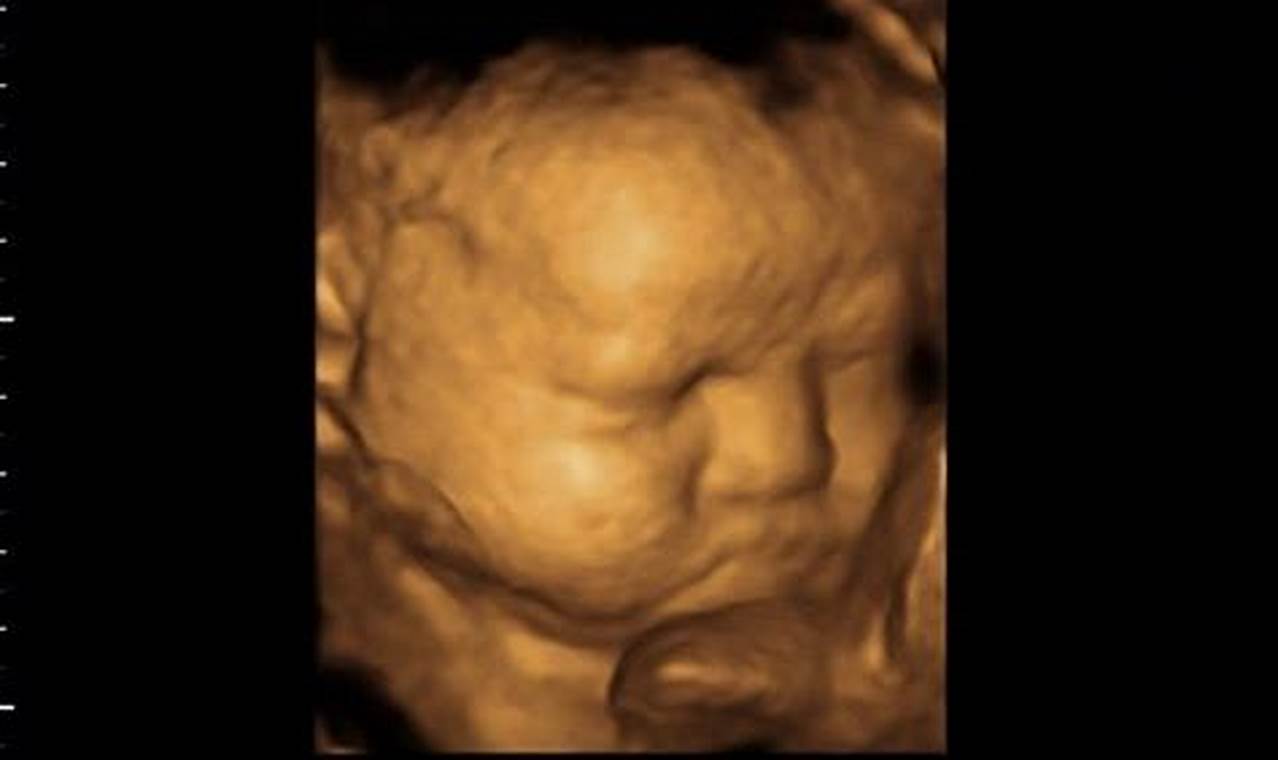 Unveil Your Baby's World: A Guide to 36-Week 3D Ultrasound