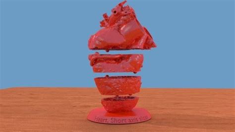 3D Printable Human Heart Model With Stackable Slices
