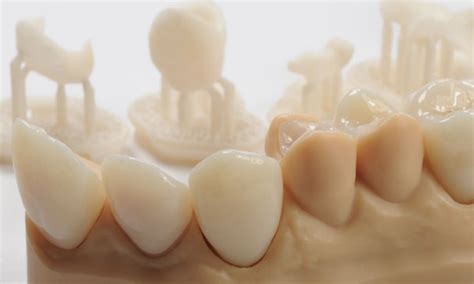 3d Printer Dental Crowns