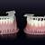 3d printing digital dentures