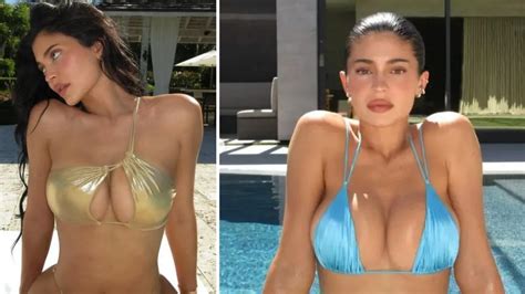 Discover the Benefits of 445 cc Implant for Natural Looking Breast Enhancement