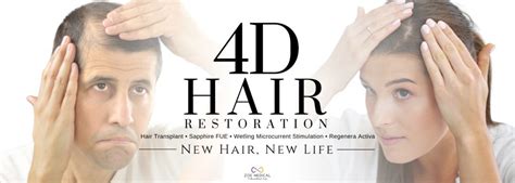 4D Hair Restoration Zoe Medical