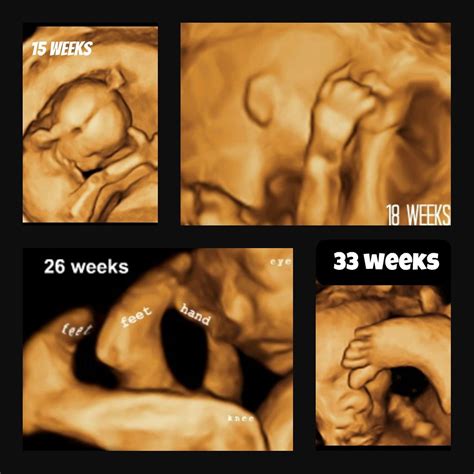4d ultrasound determine babys gender