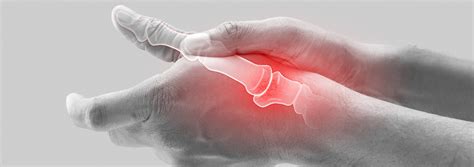 5 Essential Tips for Understanding and Treating Thumb Pain