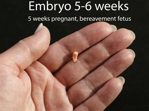 What Does a 5 Week Fetus Look Like: Developmental Milestones and Growth