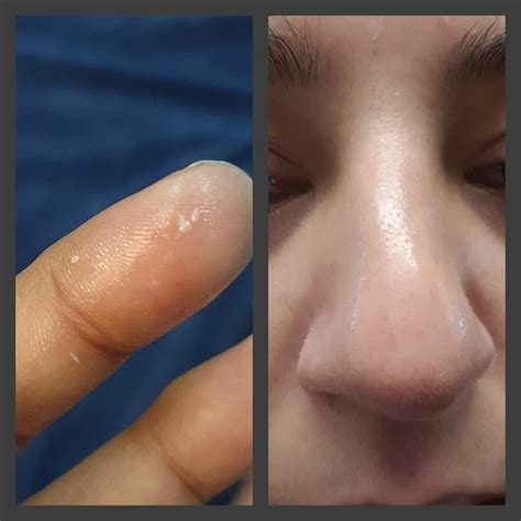 50 shades of snail method