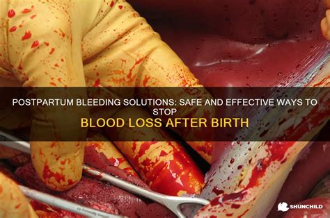 6 Effective Methods to Stop Postpartum Bleeding Quickly