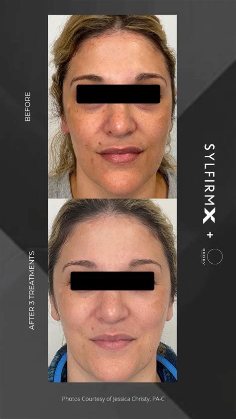 63 Laser And Skin: Your Premier Destination for Skincare Solutions