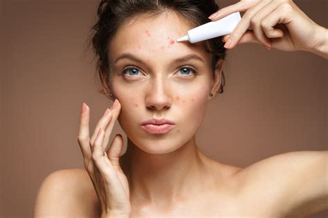 7 Little Known Acne Skin Care Secrets Acne skin, Skin care acne, Skin