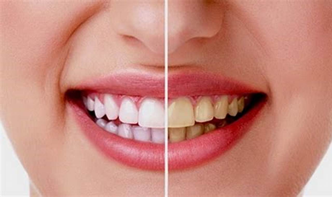 7 Rahasia Gigi Putih Penuh Pesona, Hasil Alami