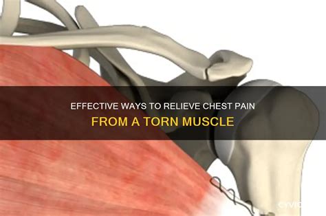 7 Effective Methods to Alleviate Burning Chest Discomfort
