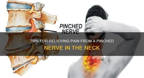 7 Effective Methods to Alleviate Pain from Pinched Nerves