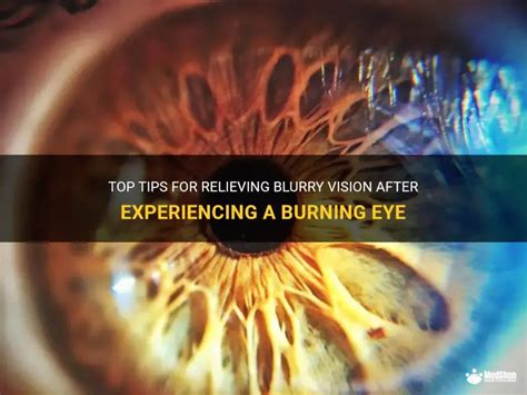 7 Essential Tips for Relieving Burning Eyes Effectively