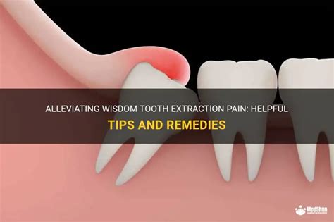 7 Tips for Alleviating Pain in Cheeks and Teeth