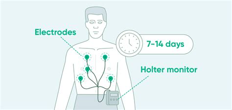 7 days heart monitor