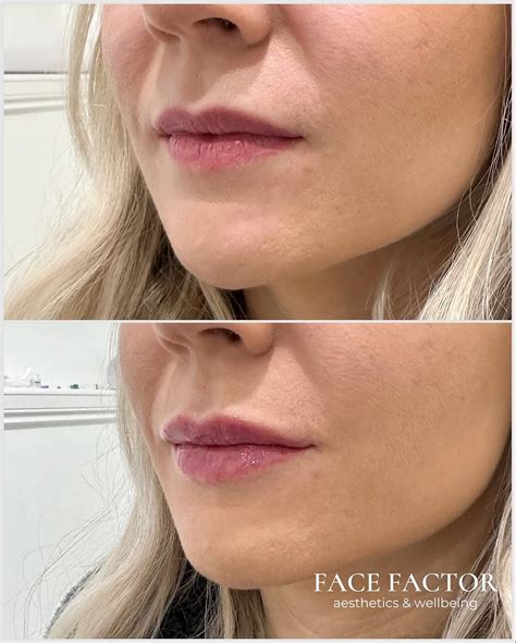 7. Factor in aesthetics