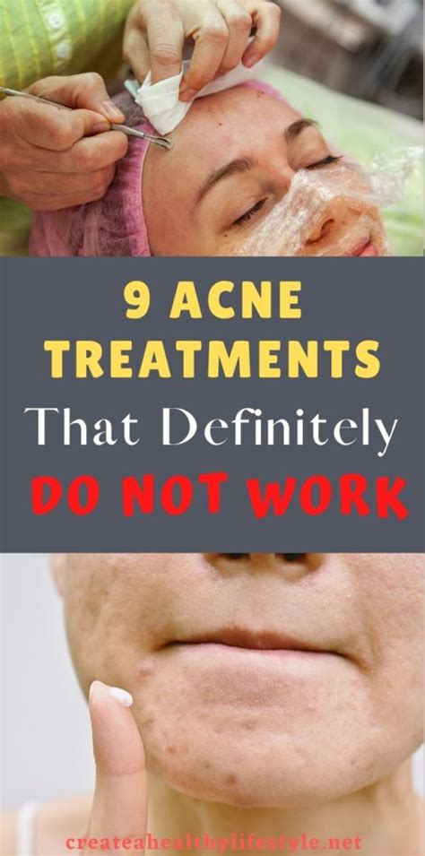 9 Acne Treatments That Definitely Do Not Work Create Healthy Lifestyle