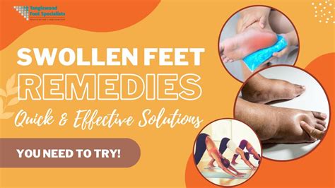 9 Effective Methods to Alleviate Swollen Feet Fast