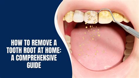 9 Effective Methods to Remove Tooth Root Remains Naturally