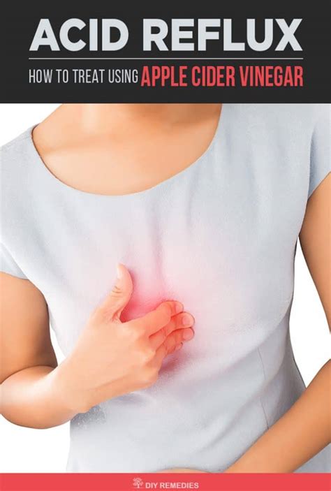 9 Tips for Safely Using Apple Cider Vinegar for Acid Reflux