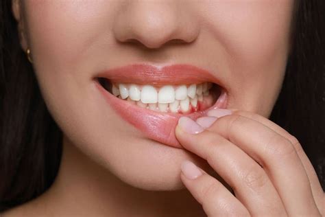 9 Uncommon Causes of Swollen Gums Without Pain Explained