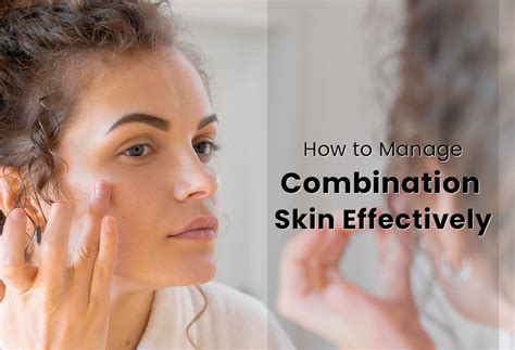 9. Essential Tips for Managing Combination Skin Effectively