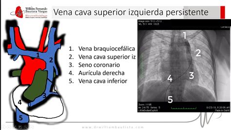 9. Vena