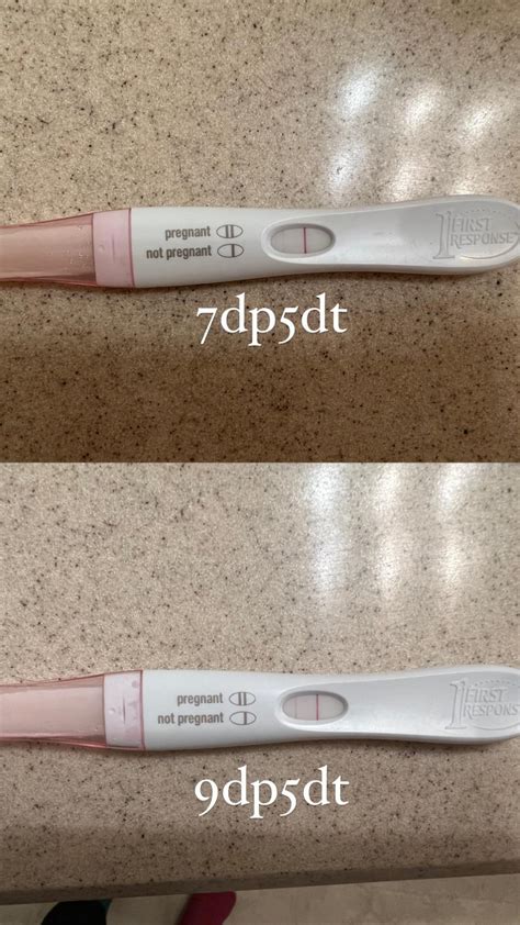 9dp5dt meaning
