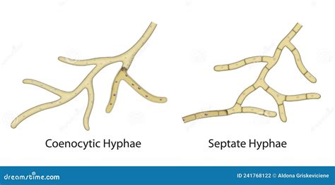 Understanding Septate Hyphae: A Brief Definition Guide