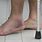 A Sprained Ankle