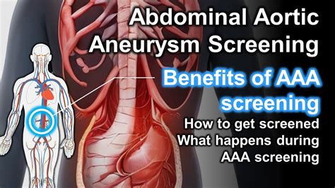 AAA Exams: Detect & Prevent Rupture Risks.