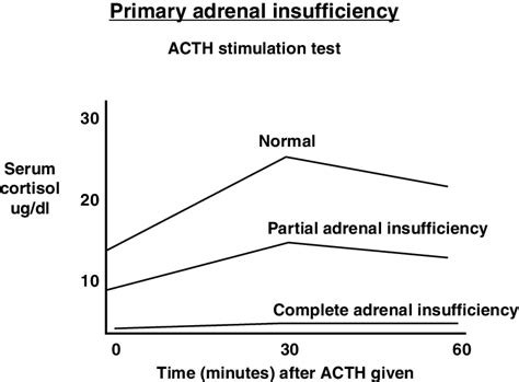 ACTH Test and interpretation