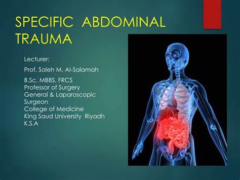Abdominal Injuries after Car Accident