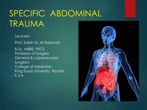Abdominal Injuries