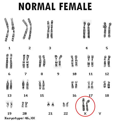 Abnormal Female