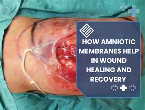 Abnormal Recovery That Should Be monitor