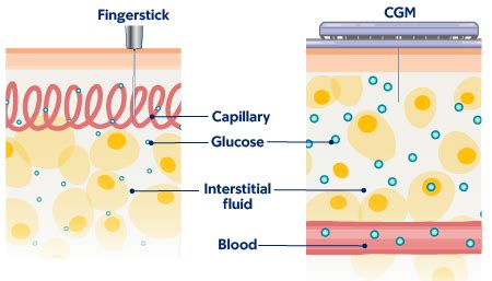 Accuracy vs. Traditional CGM