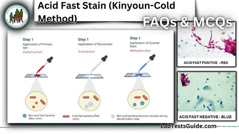 Acid-Fast Stain Test and interpretation
